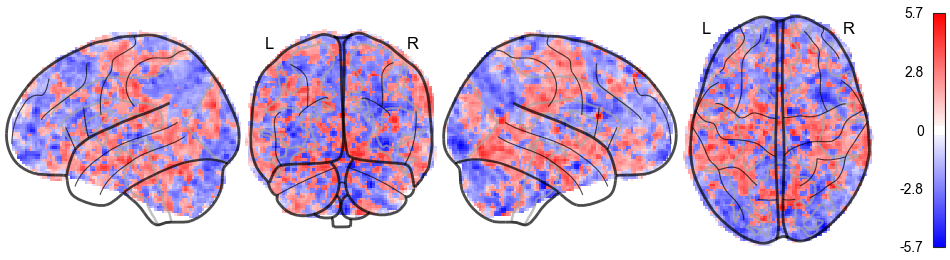 Glass brain plot, or maximum intensity projection